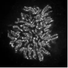 Anti Human NCAPH2 Antibody, clone 5F2G4 gallery image 1