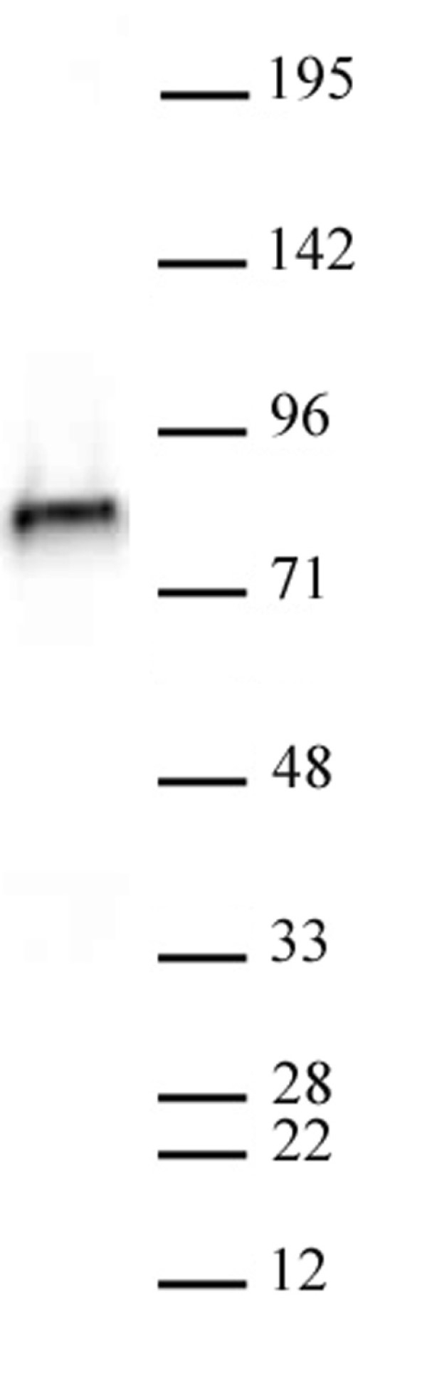 Anti Human NCAPH2 Antibody, clone 5F2G4 gallery image 2