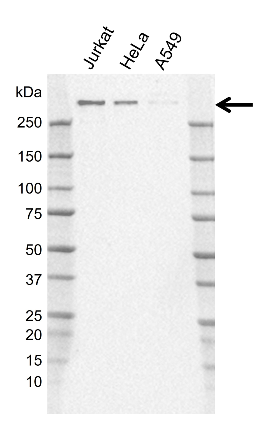 Anti Human NCOR1 Antibody, clone J02/11D2-8 gallery image 1