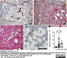 Anti Human Nestin Antibody, clone 10C2 gallery image 10