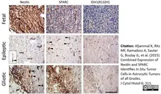 Anti Human Nestin Antibody, clone 10C2 gallery image 3