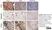 Anti Human Nestin Antibody, clone 10C2 thumbnail image 3