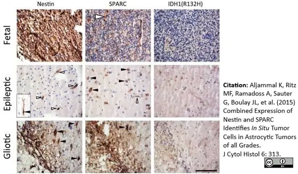 Anti Human Nestin Antibody, clone 10C2 gallery image 3
