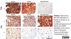 Anti Human Nestin Antibody, clone 10C2 gallery image 4