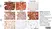 Anti Human Nestin Antibody, clone 10C2 thumbnail image 4