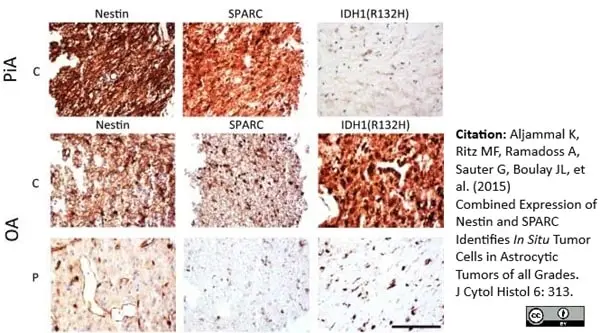 Anti Human Nestin Antibody, clone 10C2 gallery image 4