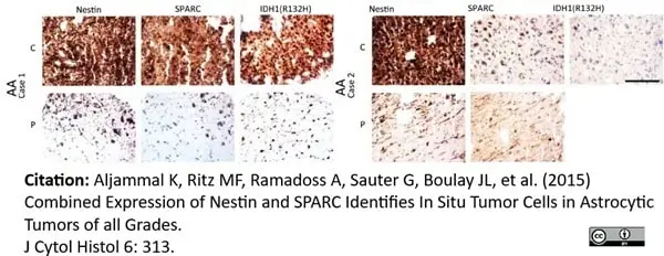Anti Human Nestin Antibody, clone 10C2 gallery image 6