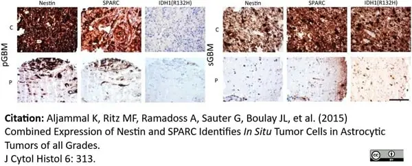 Anti Human Nestin Antibody, clone 10C2 gallery image 7