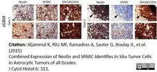 Anti Human Nestin Antibody, clone 10C2 gallery image 8