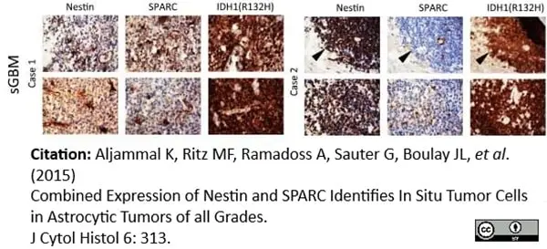 Anti Human Nestin Antibody, clone 10C2 gallery image 8