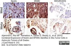 Anti Human Nestin Antibody, clone 10C2 gallery image 9