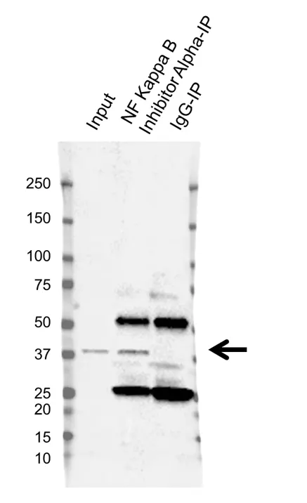 Anti NF Kappa B Inhibitor Alpha Antibody, clone OTI1D4 (PrecisionAb Monoclonal Antibody) gallery image 2