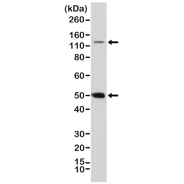 Anti NFkB p105/p50 Antibody, clone RM299 gallery image 1