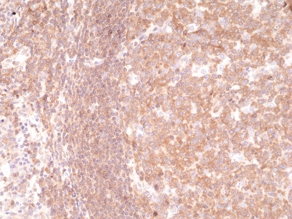 Anti NFkB p105/p50 Antibody, clone RM299 thumbnail image 2