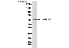 Anti NFkB p65 Antibody, clone RM273 gallery image 1