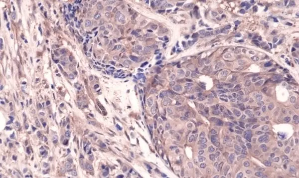 Anti NFkB p65 Antibody, clone RM273 gallery image 2