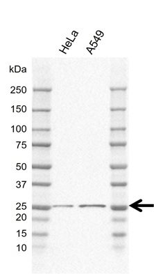 Anti Nnmt Antibody, clone EF02/2D5 (PrecisionAb Monoclonal Antibody) gallery image 1