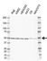 Anti NOB1 Antibody, clone F02/5F11 (PrecisionAb Monoclonal Antibody) thumbnail image 1