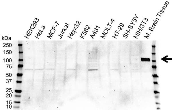 Anti NTRK3 Antibody, clone OTI24B3 (PrecisionAb Monoclonal Antibody) gallery image 1