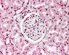 Anti Human Nuclear Antigen Antibody, clone 1415-1 (21NC85) gallery image 1