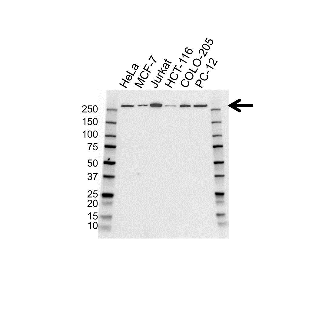 Anti NUMA1 Antibody (PrecisionAb Monoclonal Antibody) gallery image 1