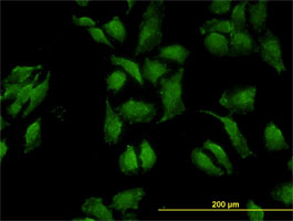 Anti Human OCLN Antibody, clone 1G7 gallery image 2