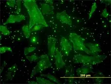 Anti Human Osteocalcin Antibody, clone 2D4 gallery image 1