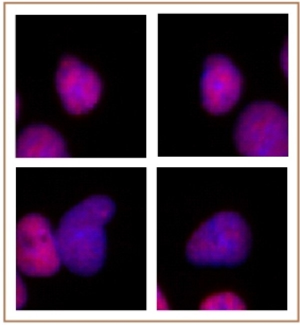 Anti Human p300 Antibody, clone NM11 gallery image 1