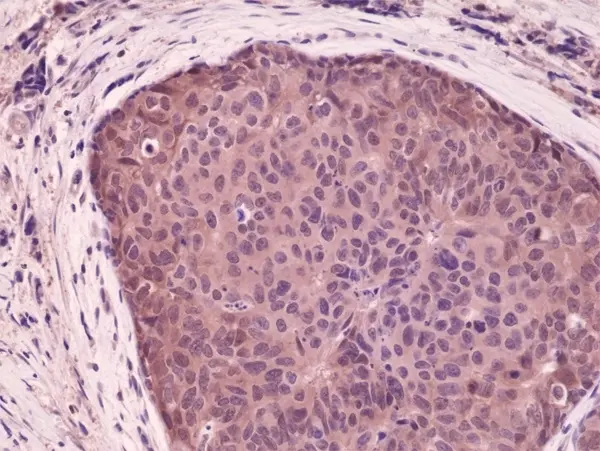 Anti p38 MAPK Antibody, clone RM245 gallery image 2