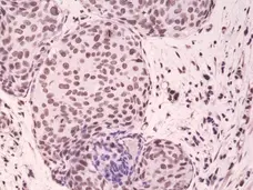 Anti p38 MAPK (pThr180/pTyr182) Antibody, clone RM243 gallery image 2