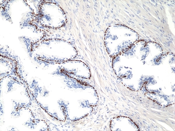 Anti p40 (deltaNp63) Antibody, clone RM392 gallery image 1