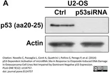 Anti p53 (aa20-25) Antibody, clone DO-1 (Monoclonal Antibody Antibody) gallery image 2