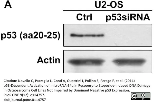Anti p53 (aa20-25) Antibody, clone DO-1 (Monoclonal Antibody Antibody) gallery image 2