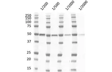 Anti Human p53 (aa181-190) Antibody, clone DO-11 gallery image 1