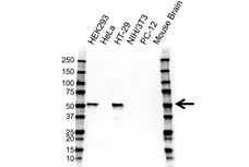 Anti p53 Antibody, clone TP53/1799R (PrecisionAb Monoclonal Antibody) gallery image 1