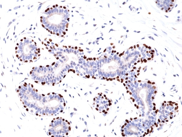 Anti p63 Antibody, clone RM383 gallery image 1