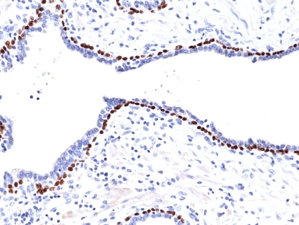 Anti p63 Antibody, clone RM383 gallery image 2