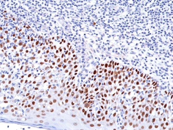 Anti p63 Antibody, clone RM383 gallery image 3