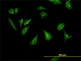 Anti Human p70S6K Antibody, clone 1E12 gallery image 2
