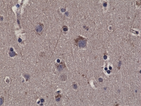 Anti P90RSK1 (pThr359/pSer363) Antibody, clone RM233 gallery image 2