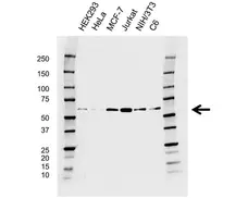 Anti PAK1 Antibody, clone CD04/3E5 (PrecisionAb Monoclonal Antibody) gallery image 1
