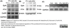 Anti Human Parathyroid Hormone Antibody, clone BGN/1F8 gallery image 1