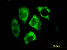 Anti Human Parkin Antibody, clone 1H4 gallery image 2
