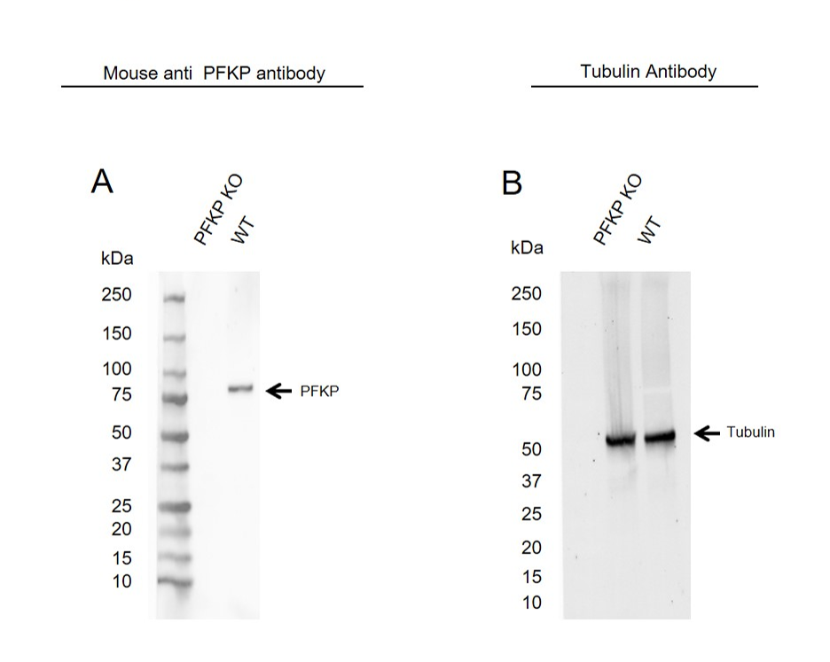 Anti PFKP Antibody, clone OTI1F2 (PrecisionAb Monoclonal Antibody) gallery image 1