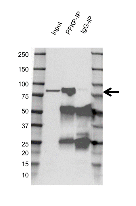 Anti PFKP Antibody, clone OTI1F2 (PrecisionAb Monoclonal Antibody) gallery image 4