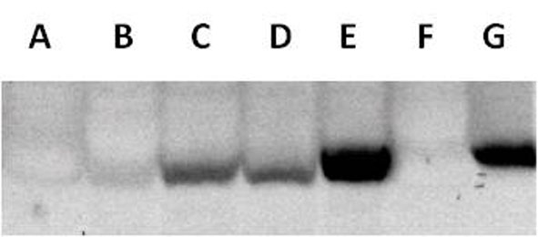 Anti Human Phenylalanine-4-Hydroxylase Antibody, clone AbD12257 gallery image 1