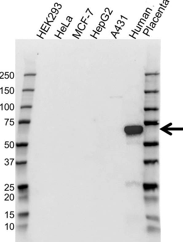 Anti Placental Alkaline Phosphatase Antibody (PrecisionAb Monoclonal Antibody) gallery image 1