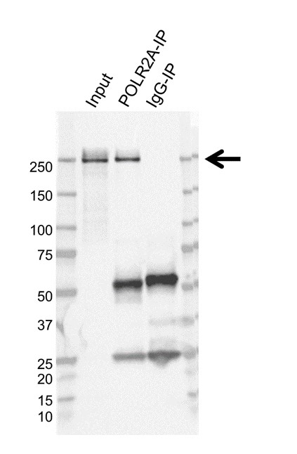 Anti POLR2A Antibody, clone AB01/3D9 (PrecisionAb Monoclonal Antibody) gallery image 2