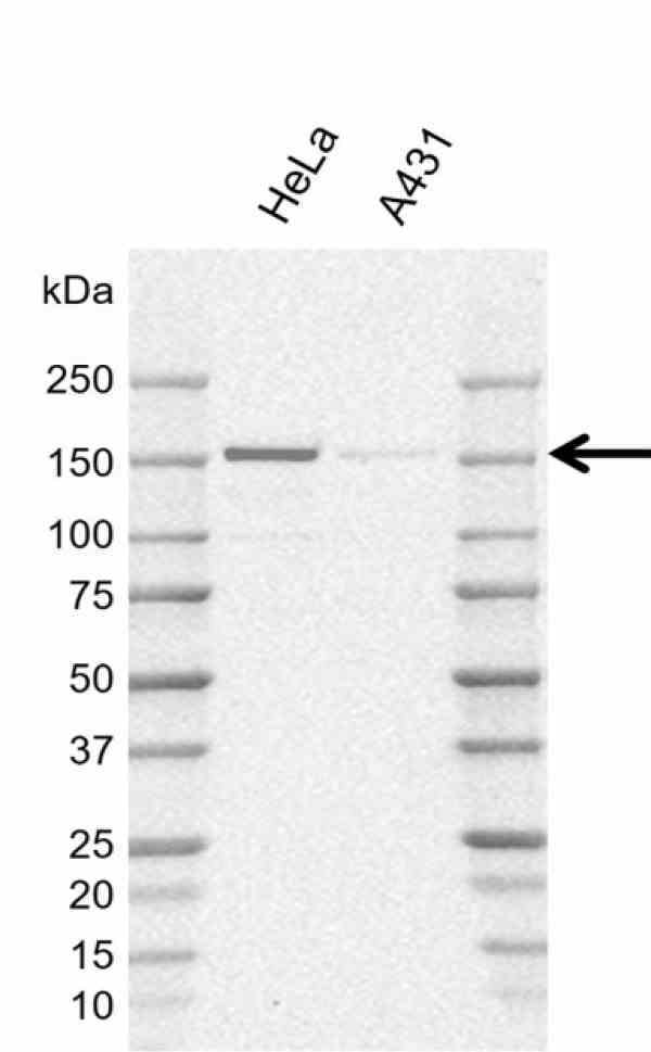 Anti Human POLR3A Antibody, clone AB01/1E10 (Monoclonal Antibody Antibody) gallery image 1