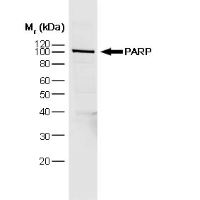 Anti Poly(ADP-Ribose) Polymerase-1 Antibody, clone A6.4.12 gallery image 1